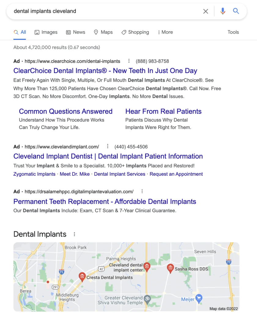 How Do Google Ads for Dentists Work?