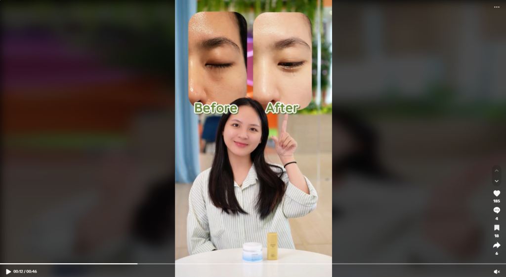 xây kênh tiktok thẩm mỹ viện Quay video Before-After